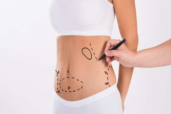 جراحی لیپوماتیک