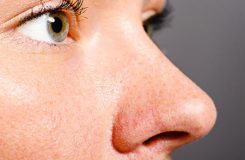 تشخیص پوست ضخیم بینی