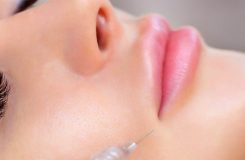 تزریق ژل لب مدل عروسکی