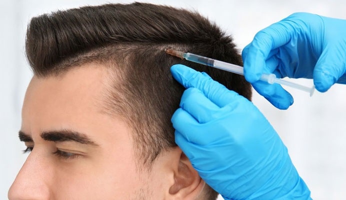 کاشت مو به روش سلولهای بنیادی