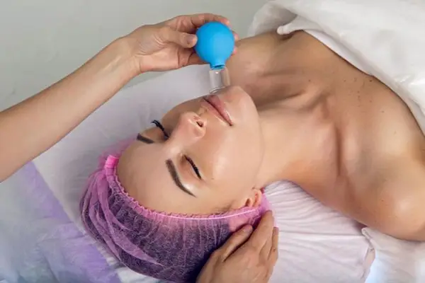 حجامت صورت برای جوش، ریش، رفع لک + عوارض و فواید حجامت صورت 1 حجامت صورت