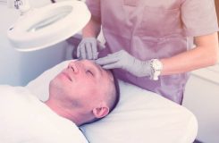 Facial swelling after hair transplant