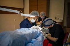 Hair transplant for women