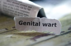 Genital Warts