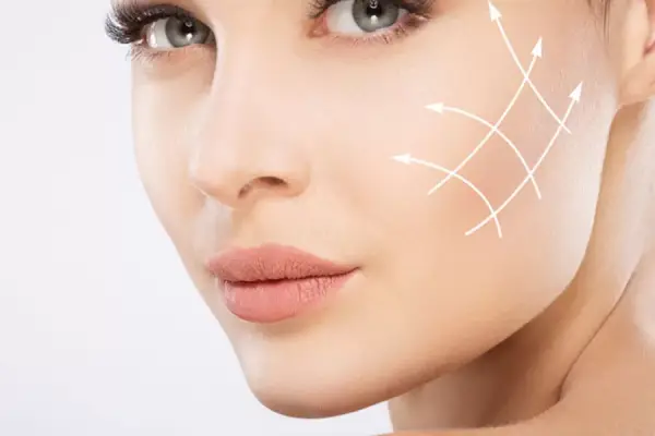 تزریق ژل صورت